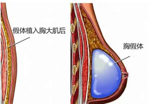 上海华美医疗美容医院是正规医院吗？医院亮点介绍