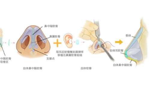上海时光做鼻综合怎么样?医院简介,一键查看
