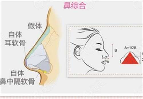 黄旭培做鼻子怎么样？医生实力曝光