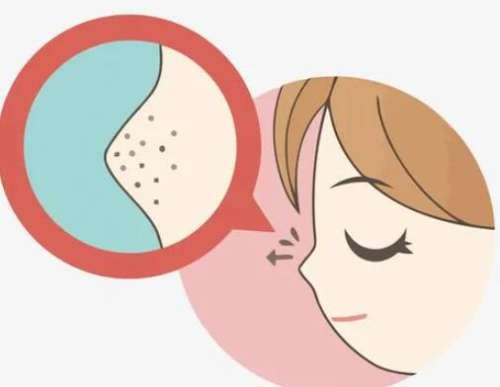 黑头导出液有用吗？分享相关科普信息