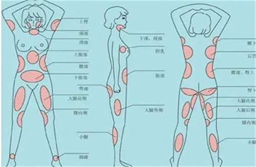 复旦大学附属华山医院整形外科抽脂怎么样？科室详情点击一览