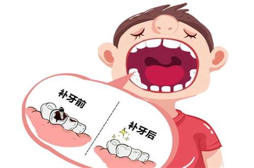 补牙2.jpg