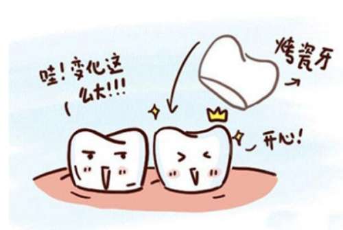 全瓷牙贴面和全瓷牙的区别?以下几个小妙招解答
