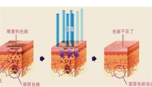 上海仁泉医疗美容祛斑怎么样?医院详细介绍
