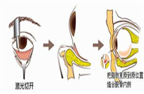 上海臻妮医疗美容怎么样?特色项目推荐