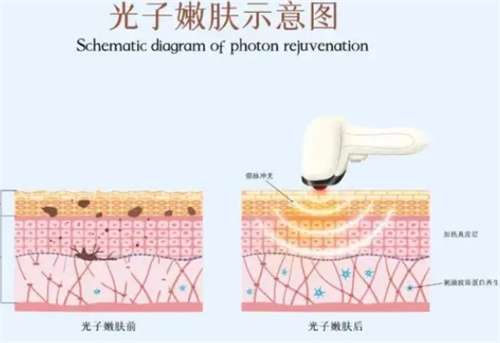 嘉兴第一医院可以做光子嫩肤吗?医院口碑点评