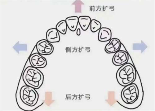 门牙矫正多少钱价格表2025?门牙矫正可以只矫正门牙吗?