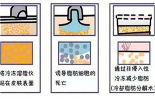 美莱医疗抽脂好吗？一文了解医院信息