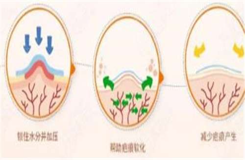 上海镜面医疗美容祛疤多少钱?医院详情介绍