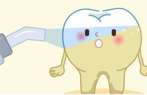 大黄牙怎么变白快有效?大黄牙可以做瓷贴面吗?
