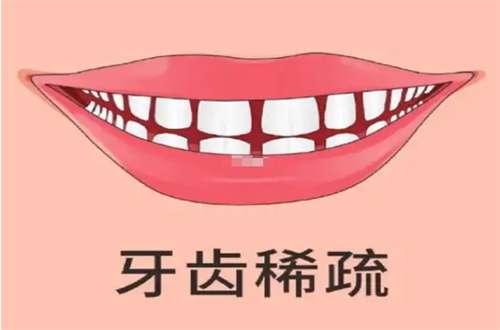 牙齿稀疏2.jpg