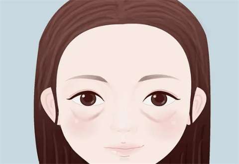黑眼圈眼袋太重怎么消除?多种医美方法已经公布