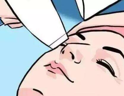 欧洲之星4d做一次效果怎么样？不踩雷的变美路径全指南