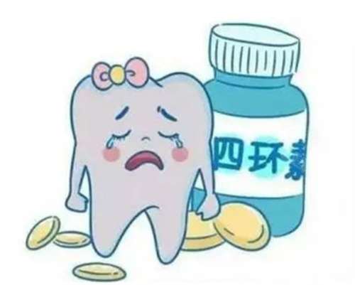 四环素牙齿怎么变白好方法?如何形成的?