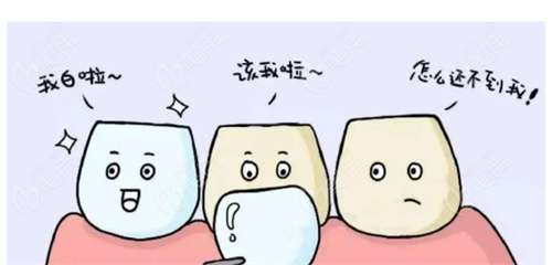 牙齿贴面步骤全过程介绍!牙齿贴面颜色怎么选?