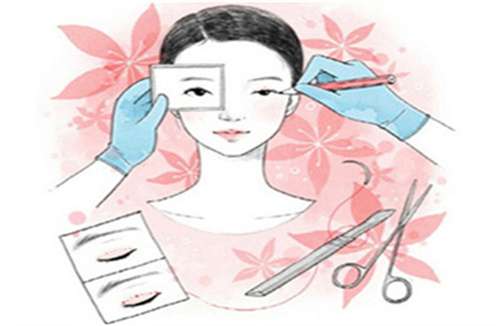 产慎之做肿泡眼怎么样？医生特色项目在线了解