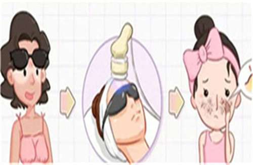 dpl黑金超光子和m22光子的区别在哪里?dpl黑金超光子祛斑好吗?