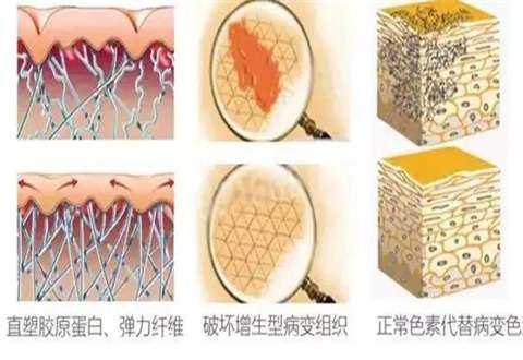 疤痕修复手术一般多少钱?详细注意事项已经分享