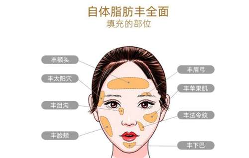 自体脂肪填充川字纹可以维持多久?多久消肿?