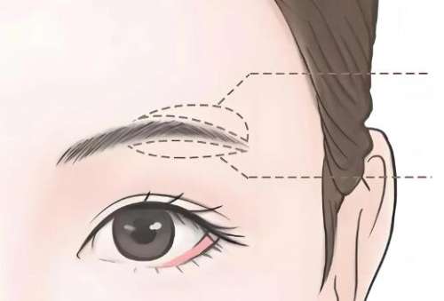 做眉弓为什么显老?了解人气项目简介一览