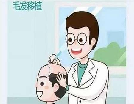 植发有用吗?可以维持多久?详细信息科普