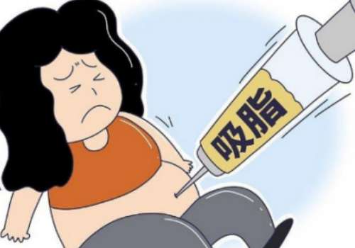 环形抽脂多少钱？多久上班？保持多久？