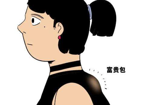 苏浩东整形医生做富贵包怎么样？含热门医生资料与案例过程分享