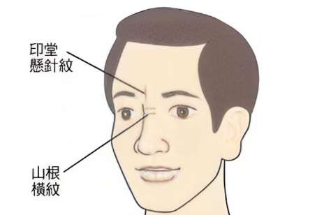 有悬针纹怎么办小妙招?有悬针纹的原因有哪些?