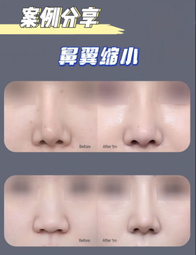 截屏2025-07-05 14.18.23.png