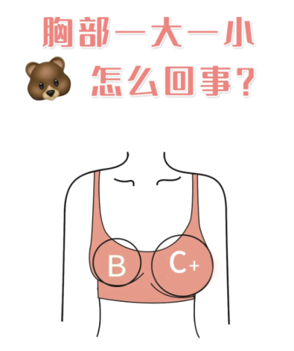 胸部一大一小怎么办?超实用解决指南来啦