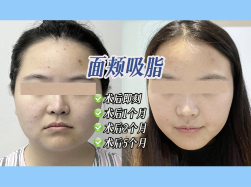 截屏2025-07-05 18.20.58.png