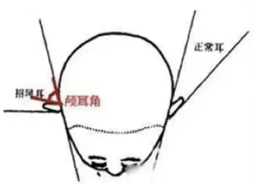 截屏2025-07-06 18.13.52.png