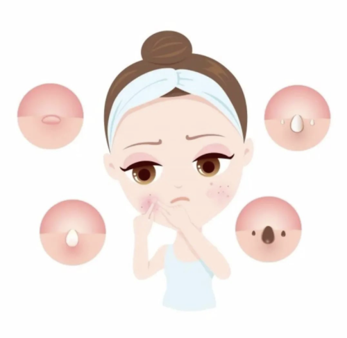 深圳看痘痘去哪个医院比较好?祛痘医院红榜大公开