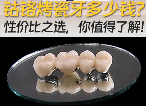 钴铬烤瓷牙齿的优缺点分析，算得上性价比之王