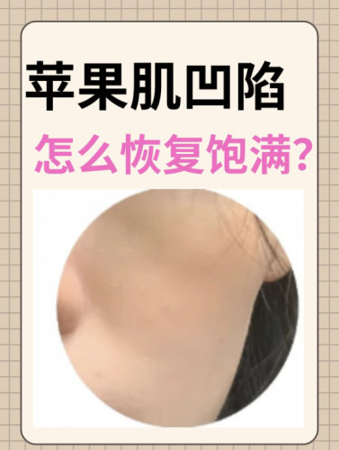 脸部凹陷怎么自然恢复饱满？ 这些 “填充术” 藏在生活里