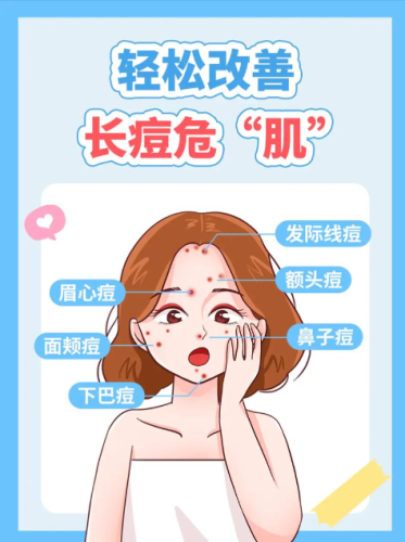 深圳痘痘治疗哪家医院好？这三家医院各的绝活你肯定不知道