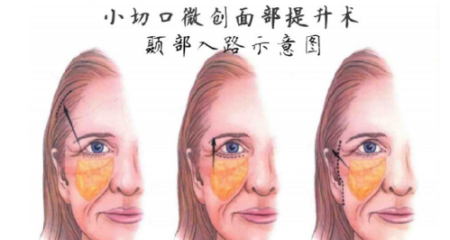 wechat_2025-07-09_135821_937.png