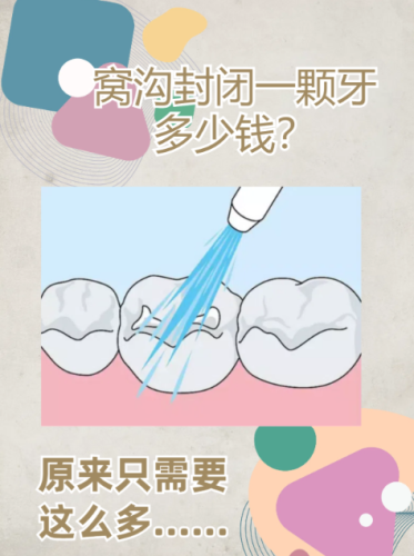 窝沟封闭价格是多少?为您解析费用构成及影响因素