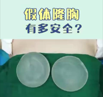 南宁假体隆胸哪家医院好？这一篇科普就够用了