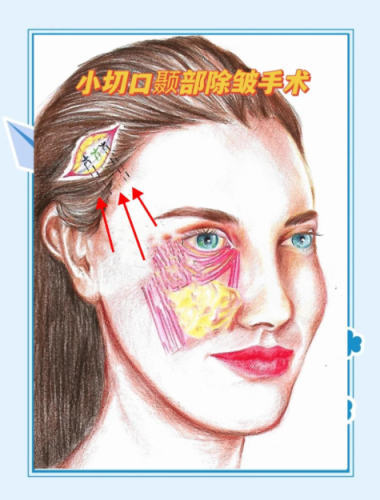 wechat_2025-07-10_111713_840.png