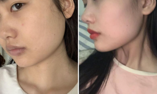 重庆安可忍磨骨好不好？从专业维度全面评估