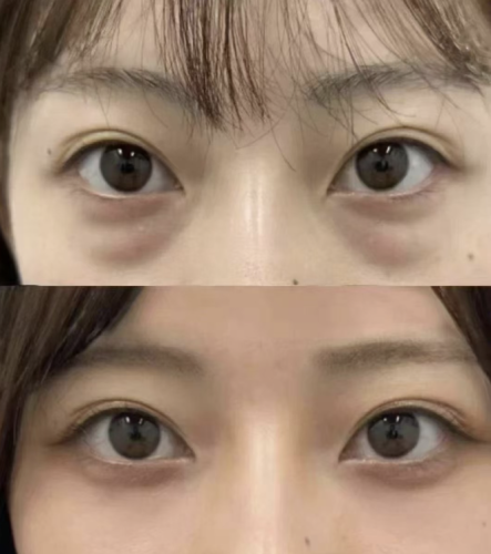 截屏2025-07-11 18.30.20.png