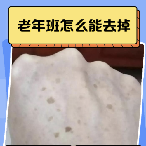 老年斑能治吗?容易去掉吗?