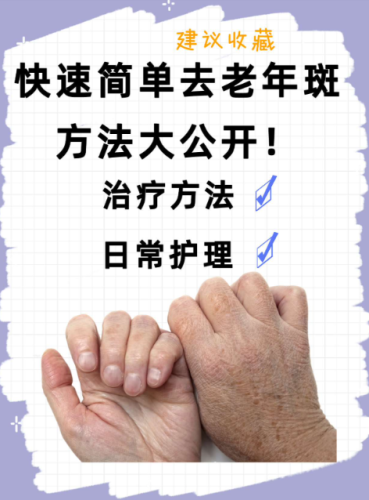如何去除老年斑?实用方法与护理建议,赶紧收藏