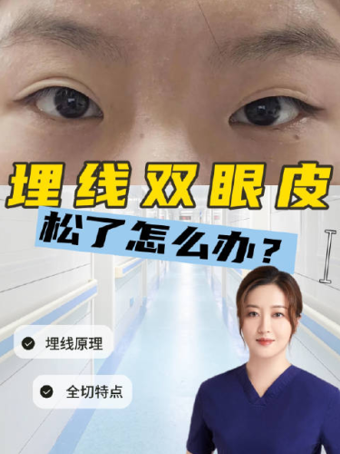上海张诗若双眼皮修复多少钱？影响价格在这些方面