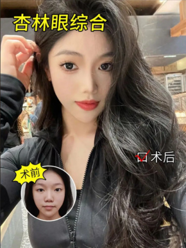 沈阳杏林哪个医生做眼部好?从实际需求选对人
