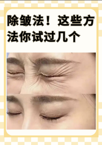 杭州第一人民医院除皱手术怎么样?求真实体验!