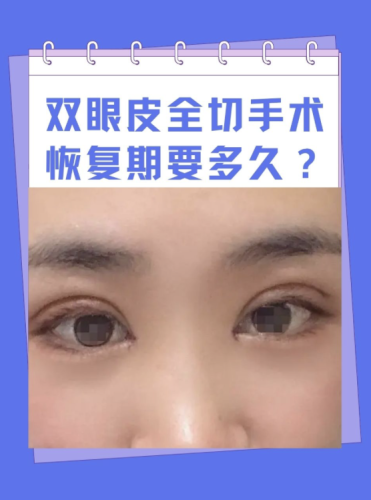 截屏2025-07-12 08.45.06.png