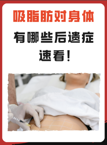 吸脂有什么后遗症和危害?警惕美丽陷阱!