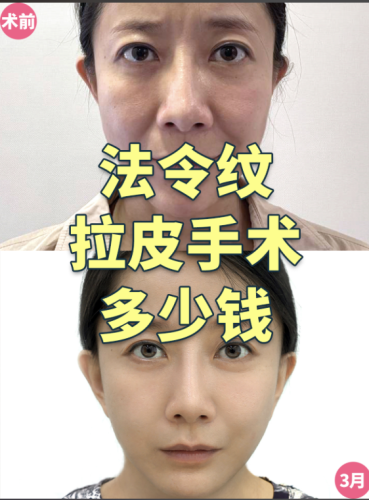 截屏2025-07-19 18.41.56.png